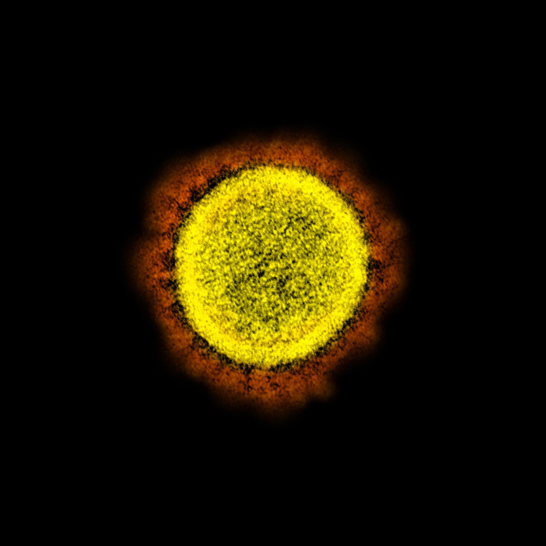 Шиповите протеини на повърхността на вируса, причинител на Covid-19, образуват характерната „корона“, която на изображението изглежда като ореол. Чрез шиповите протеини се осъществява инвазията на паразита – нахлуването в човешките клетки. Електронно микроскопско изображение: National Institute of Allergy and Infectious Diseases (NIAID)
