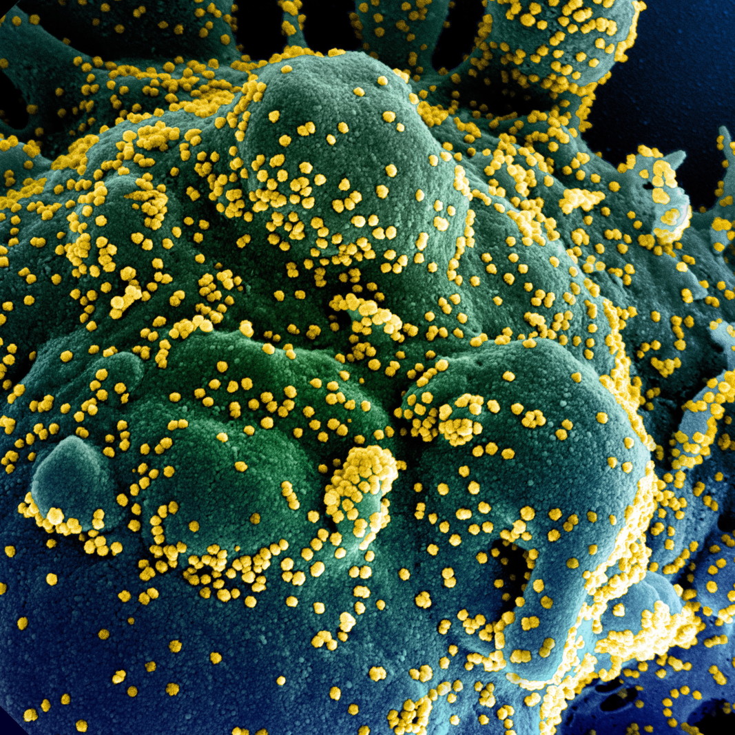Електронно микроскопско изображение на частиците на коронавируса (в жълто), причинител на Covid-19, на фона на инфектирана клетка. Изображение: National Institute of Allergy and Infectious Diseases (NIAID)