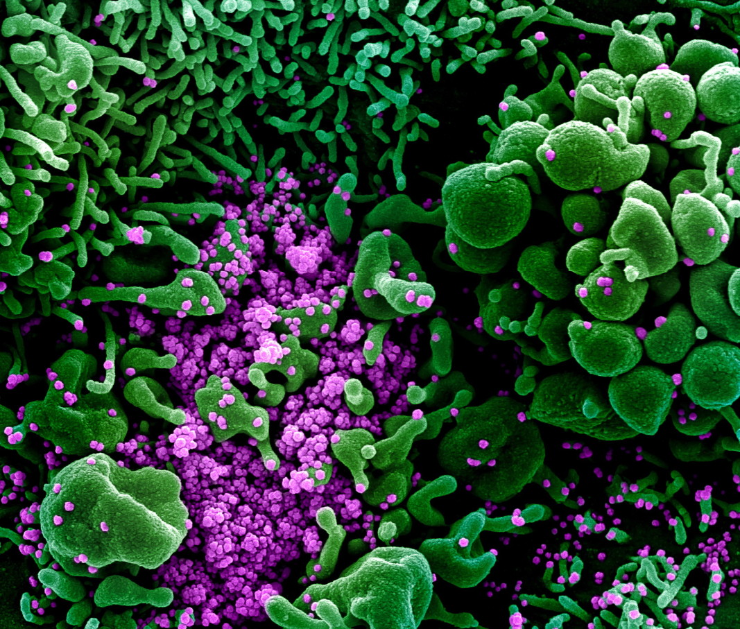 Електронно микроскопско изображение на пандемичния човешки коронавирус, причиняващ болестта Covid-19 (в лилаво), който навлиза в клетка (в зелено), National Institute of Allergy and Infectious Diseases (NIAID)