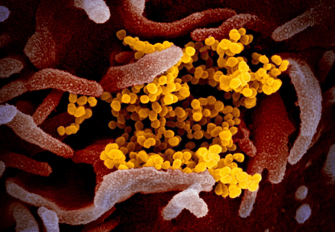 Изображение на коронавируса на Covid-19 (в жълто)