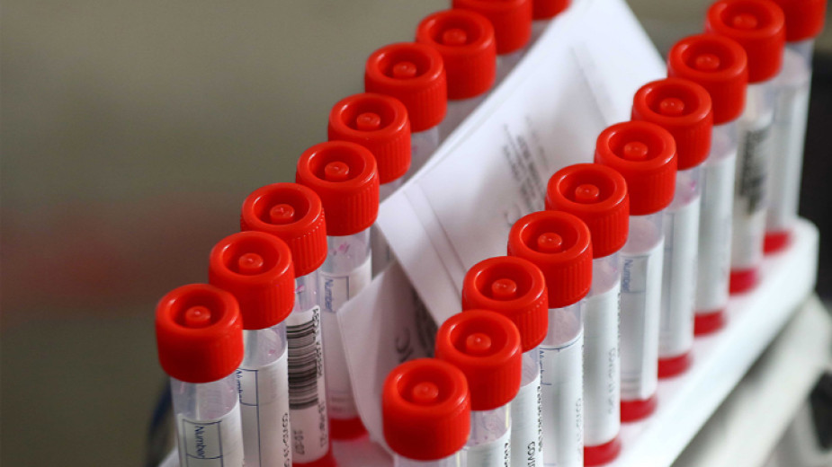 669 са новите случаи на коронавирус в България, сочат данните
