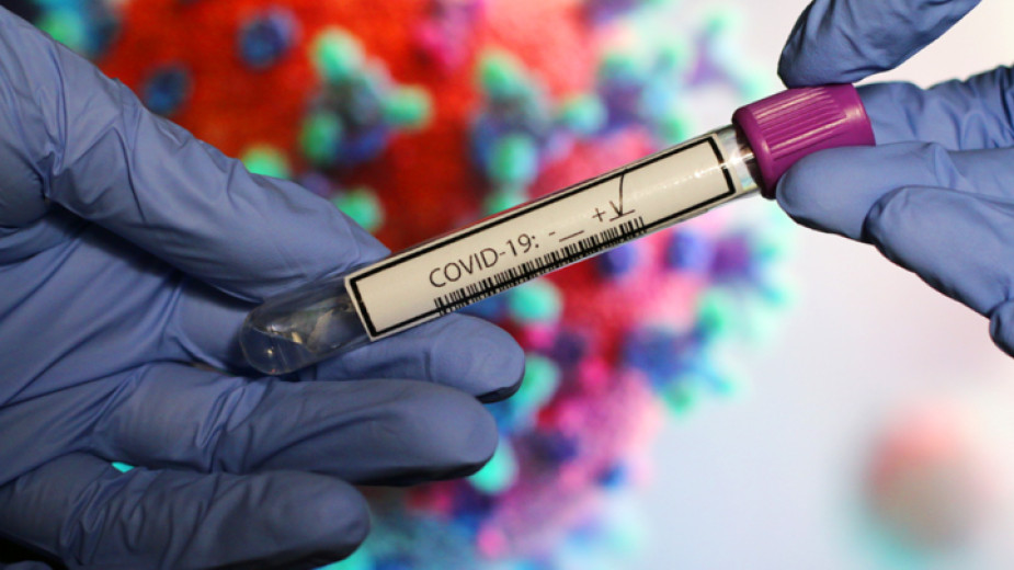 Новите случаи с коронавирус в страната са 609. Положителни са