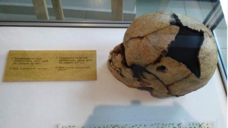 Детски череп с успешно направена трепанация. Находката е от некропол край село Одърци, Добричко и датира от XI-ти век.