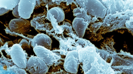 Оцветено изображение от електронен микроскоп на бактерията Yersinia pestis, причиняваща бубонна чума