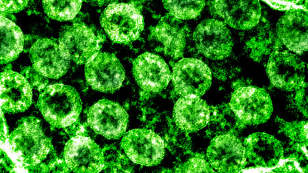 Електронно микроскопско изображение на коронавируса, причинител на Covid-19