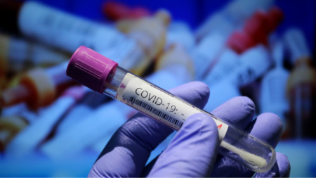 199 са новите случаи на коронавирус у нас. Положителни са