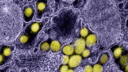 Изображение на коронавируса SARS-CoV-2, който е причинител на Covid-19,  National Institutes of Health (NIH)