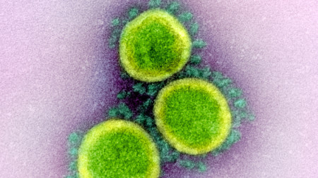 Електронно микроскопско изображение на частиците (вириони) на коронавируса, причинител на Covid-19, National Institute of Allergy and Infectious Diseases (NIAID)