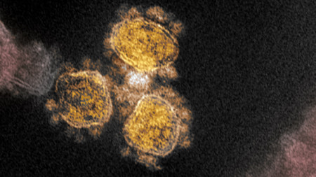 Изображение на коронавируса, причиняващ Covid-19, National Institutes of Health (NIH)