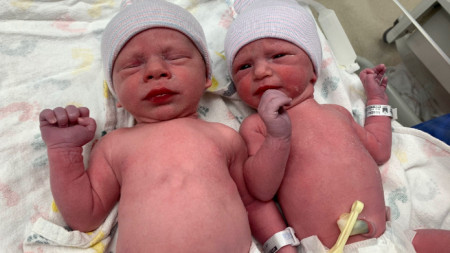 Близнаците Лидия и Тимъти Риджуей са родени на 31 октомври 2022 г.