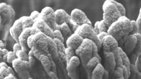 Сниманият под микроскоп нов материал, наречен нано-еноки полиетилен терефталат.
