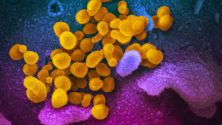 Изображение на коронавируса на COVID-19 (в жълто-оранжево) на фона на клетъчни структури.