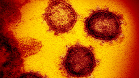 Изображение на вируса на COVID-19, National Institutes of Health (NIH) 