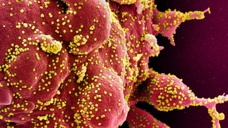 Електронно микроскопско изображение на частиците на коронавируса (в жълто), причинител на Covid-19, на фона на инфектирана клетка. Изображение: National Institute of Allergy and Infectious Diseases (NIAID)