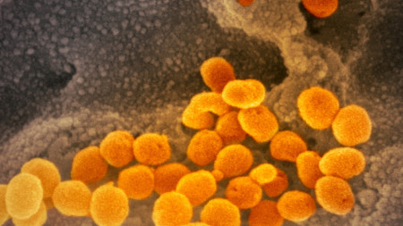 Изображение на коронавируса COVID-19(в жълто-оранжево) на фона на клетъчната мембрана (в сиво-кафяво)
