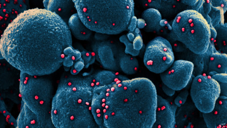 Електронно микроскопско изображение на пандемичния човешки коронавирус, причиняващ болестта Covid-19 (в червено), на фона на клетка (в синьо), National Institute of Allergy and Infectious Diseases (NIAID)