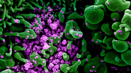 Електронно микроскопско изображение на пандемичния човешки коронавирус (в лилаво), който навлиза в клетка (в зелено).