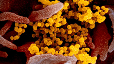 Изображение на коронавируса COVID-19 (в жълто)