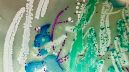Аксиния Пейчева, Приказка за края (част първа), 2020-2021. 
Бактериална посявка върху агар (35-50 см), мозайка от синтетични тесери върху плексиглас (35-50 см), принт върху хартия
