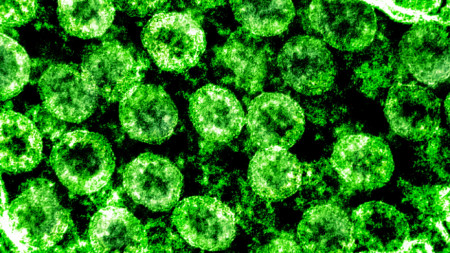 Изображение на новия коронавирус, причинител на Covid-19, National Institutes of Health (NIH)