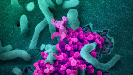 Изображение на коронавируса, причинител на Covid-19