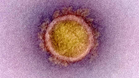 Изображение на новия коронавирус, причинител на Covid-19, National Institutes of Health (NIH) 