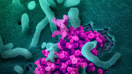 Изображение на новия коронавирус, причинител на COVID-19,  National Institutes of Health (NIH)