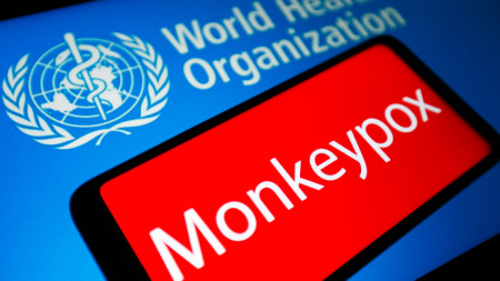 Случаят на маймунска шарка който Гърция обяви за съмнителен не