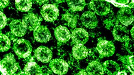 Изображение на коронавируса, причинител на Covid-19, National Institutes of Health (NIH)