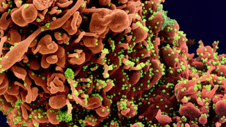 Електронно микроскопско изображение на частиците на коронавируса (в зелено), причинител на Covid-19, на фона на инфектирана клетка. Изображение: National Institute of Allergy and Infectious Diseases (NIAID)