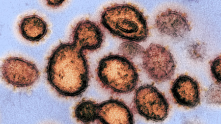 Изображение на новия коронавирус, причинител на COVID-19