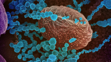 Изображение на новия коронавирус, причиняващ COVID-19 - в синьо-зелено,  National Institutes of Health (NIH) 