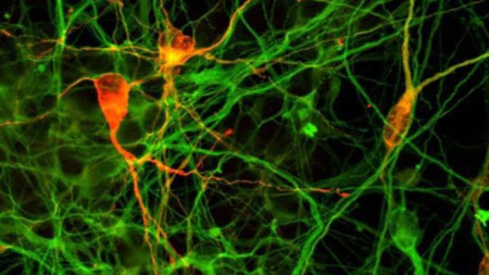 Неврони, микроскопско изображение